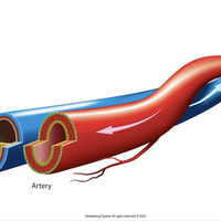 vein