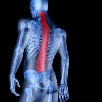 spinal injury