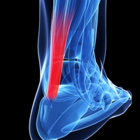 Achilles tendon