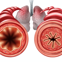 bronchioles