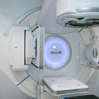 radiotherapy